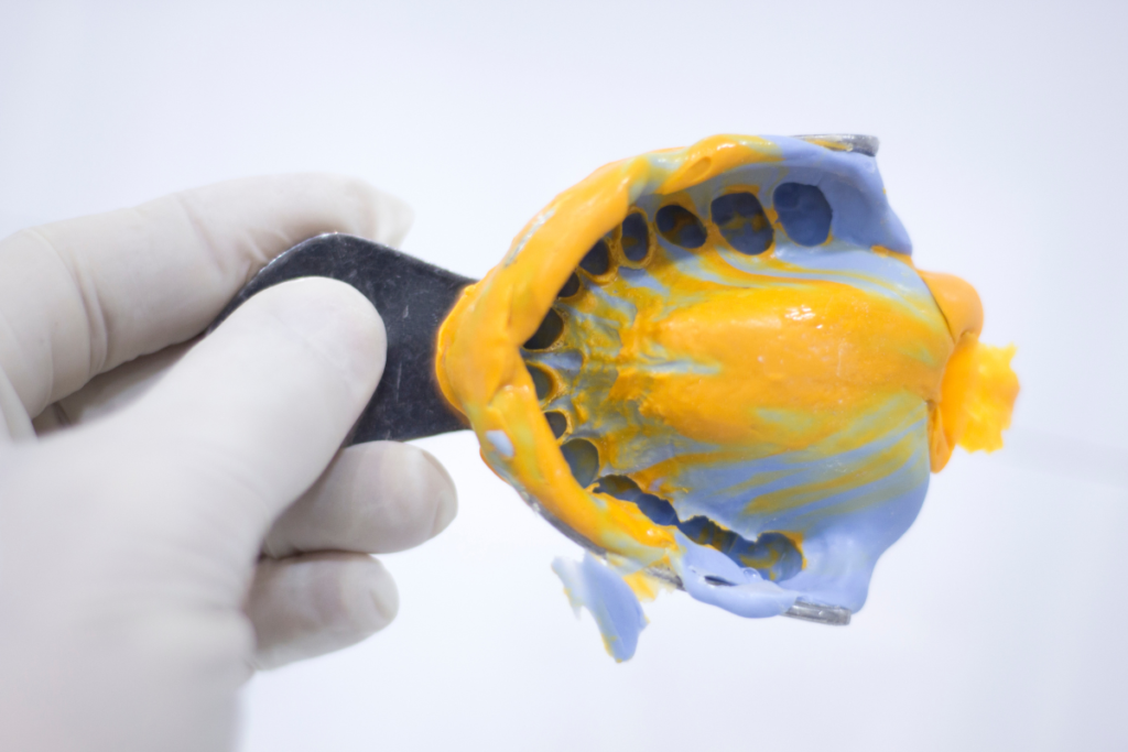 Alginate in Dentistry